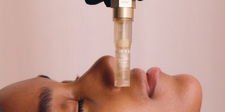 Seattle Women Are Turning to Salmon Sperm Injections