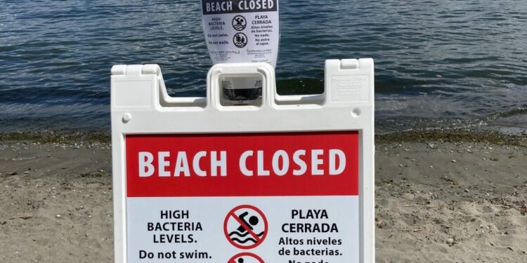 King County Closes Eight Beaches Due to High Bacteria Levels and Toxic Algae
