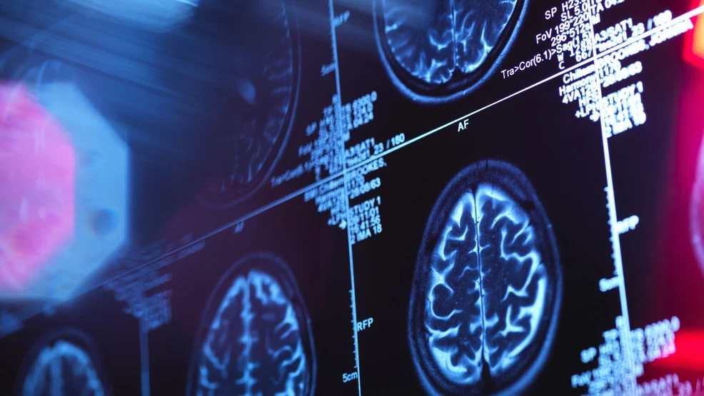 Picture Credit: KOMO News