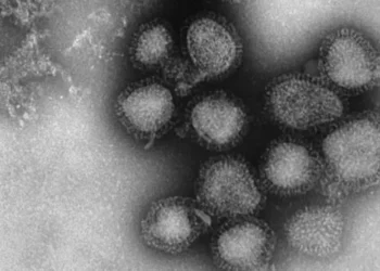 Picture Credit: KMTR