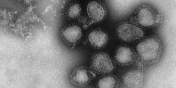 Picture Credit: KMTR