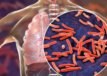 Picture Credit: KOMO News