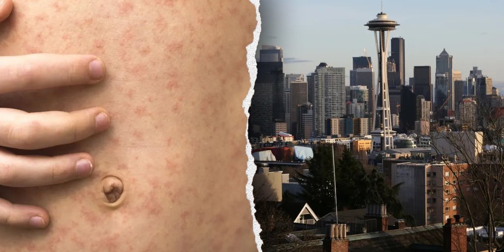 Picture Credit: Fox News 